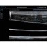 УЗИ-аппарат Mindray DC-40 УЗИ-аппарат Mindray DC-40