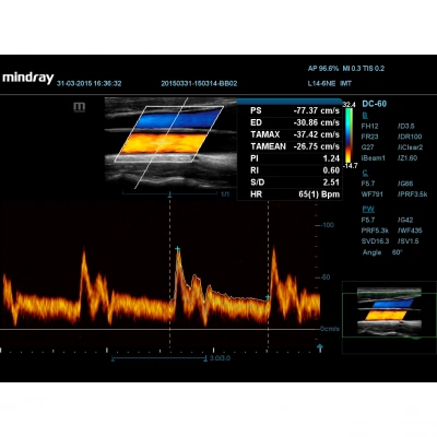 УЗИ-аппарат Mindray DC-60 Pro X-Insight УЗИ-аппарат Mindray DC-60 Pro X-Insight