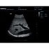 УЗИ-аппарат Mindray DC-60 Pro X-Insight УЗИ-аппарат Mindray DC-60 Pro X-Insight
