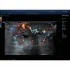 УЗИ-аппарат Mindray DC-80 Pro X-Insight УЗИ-аппарат Mindray DC-80 Pro X-Insight