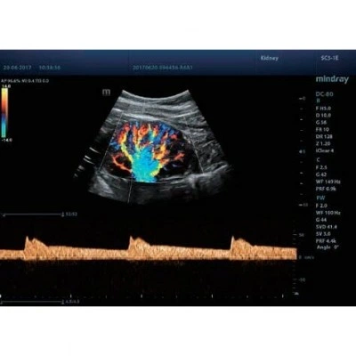 УЗИ-аппарат Mindray DC-80 Pro X-Insight УЗИ-аппарат Mindray DC-80 Pro X-Insight