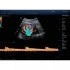 УЗИ-аппарат Mindray DC-80 Pro X-Insight УЗИ-аппарат Mindray DC-80 Pro X-Insight