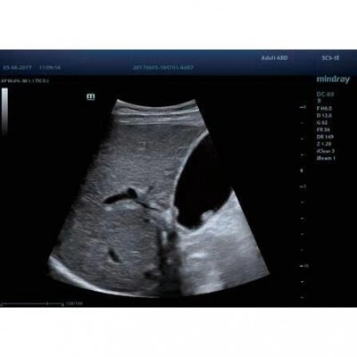 УЗИ-аппарат Mindray DC-80 Pro X-Insight УЗИ-аппарат Mindray DC-80 Pro X-Insight