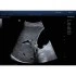 УЗИ-аппарат Mindray DC-80 Pro X-Insight УЗИ-аппарат Mindray DC-80 Pro X-Insight