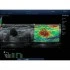 УЗИ-аппарат Mindray DC-80 Pro X-Insight УЗИ-аппарат Mindray DC-80 Pro X-Insight