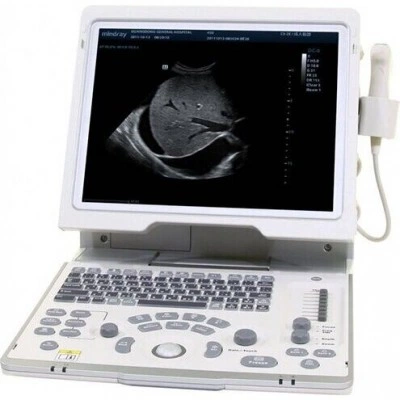Портативный УЗИ-аппарат Mindray DP-50 Портативный УЗИ-аппарат Mindray DP-50