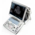 Портативный УЗИ-аппарат Mindray DP-50 Портативный УЗИ-аппарат Mindray DP-50