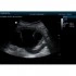 Портативный УЗИ-аппарат Mindray DP-50 Портативный УЗИ-аппарат Mindray DP-50