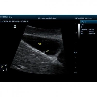 Портативный УЗИ-аппарат Mindray DP-50 Портативный УЗИ-аппарат Mindray DP-50