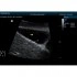 Портативный УЗИ-аппарат Mindray DP-50 Портативный УЗИ-аппарат Mindray DP-50