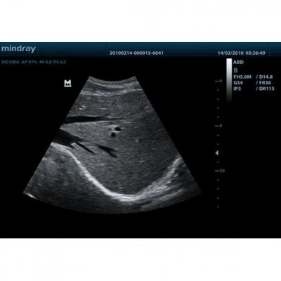 Портативный УЗИ-аппарат Mindray DP-50 Портативный УЗИ-аппарат Mindray DP-50