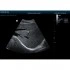 Портативный УЗИ-аппарат Mindray DP-50 Портативный УЗИ-аппарат Mindray DP-50
