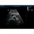 Портативный УЗИ-аппарат Mindray DP-50 Портативный УЗИ-аппарат Mindray DP-50