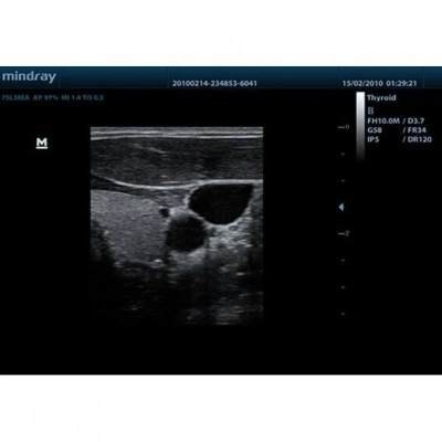 Портативный УЗИ-аппарат Mindray DP-50 Портативный УЗИ-аппарат Mindray DP-50