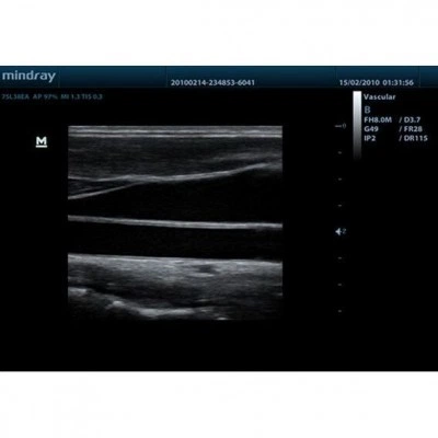 Портативный УЗИ-аппарат Mindray DP-50 Портативный УЗИ-аппарат Mindray DP-50