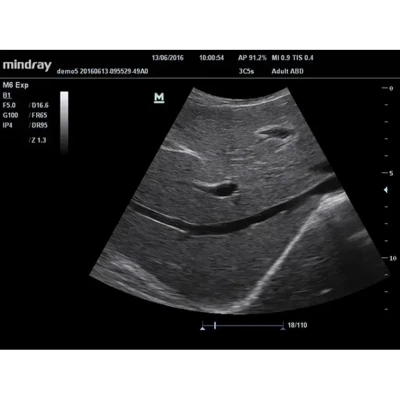 УЗИ-аппарат Mindray M5 New (Premium) УЗИ-аппарат Mindray M5 New (Premium)