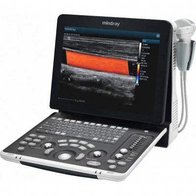 УЗИ-аппарат Mindray Z60 УЗИ-аппарат Mindray Z60